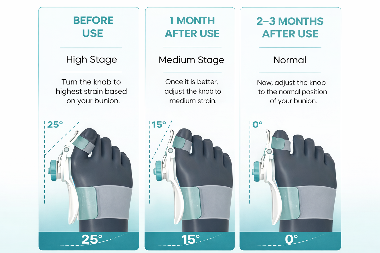 FootAlign™ Orthopedic Toe Straightener Bunion Relief For Adults